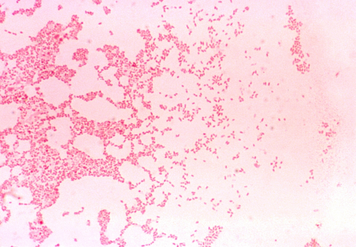 Un estudio revela cómo la bacteria de la brucelosis se oculta del sistema inmunológico en el abdomen